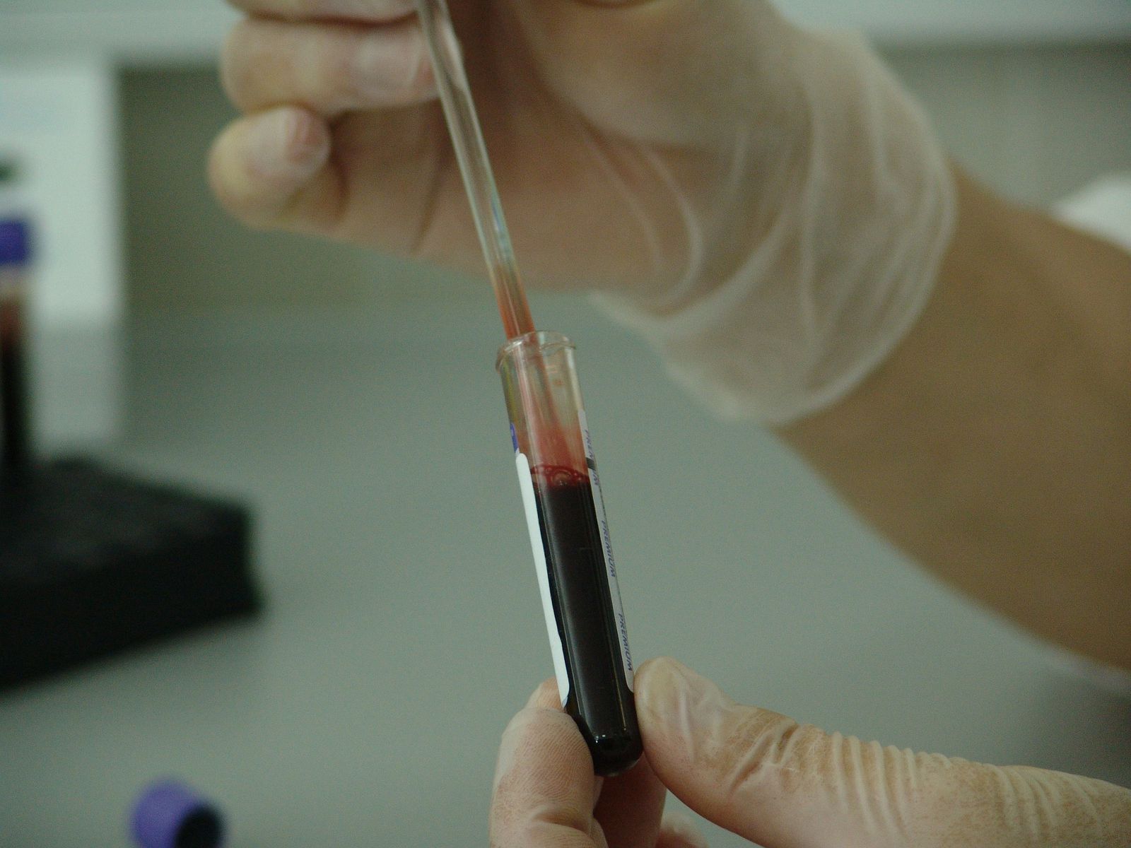 30 ноября в Прикамье пройдёт массовое экспресс-тестирование на ВИЧ